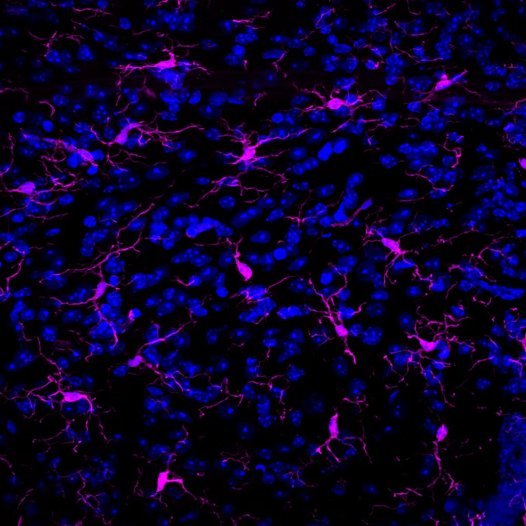 Campo experimental con estructuras magenta y núcleos azules sobre fondo negro.