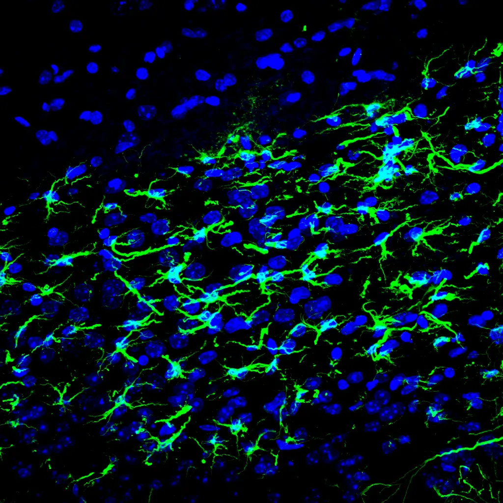 Campo experimental con estructuras verdes y núcleos azules sobre fondo negro.