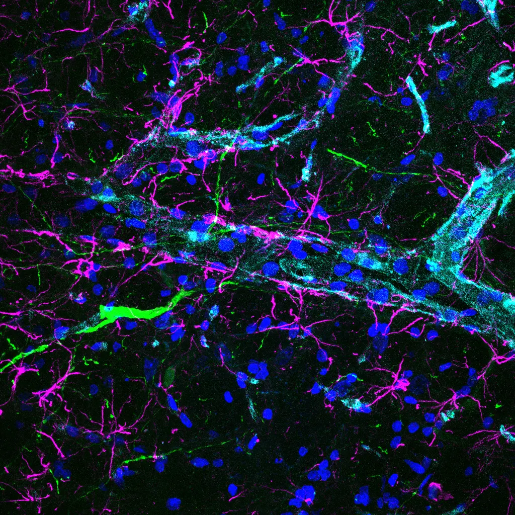 Micrografía de inmunofluorescencia del laboratorio con señales verdes, rojas, cian y azules sobre fondo negro.